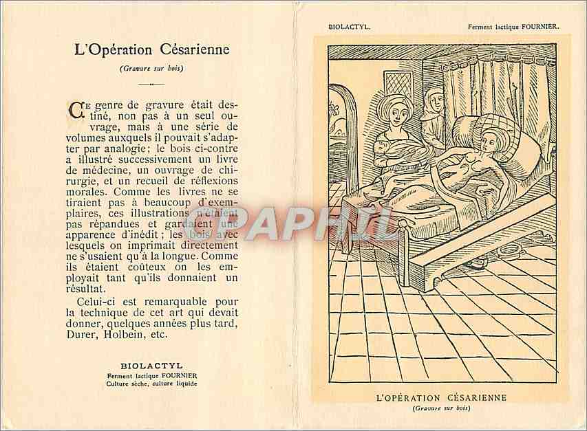 Opération Césarienne — gravure sur bois — éditée par Les Laboratoires Fournier Frères — Rückseite