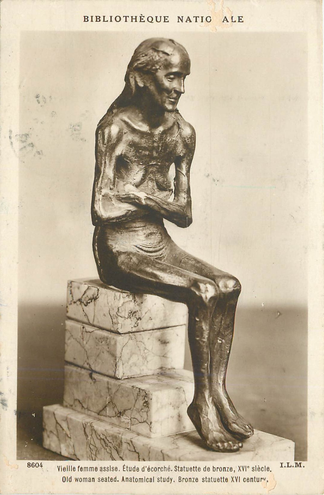 Statue einer alten sitzenden Frau — Anatomische Studie, Bronze, 16. Jahrhundert — I.L.M. n° 8604