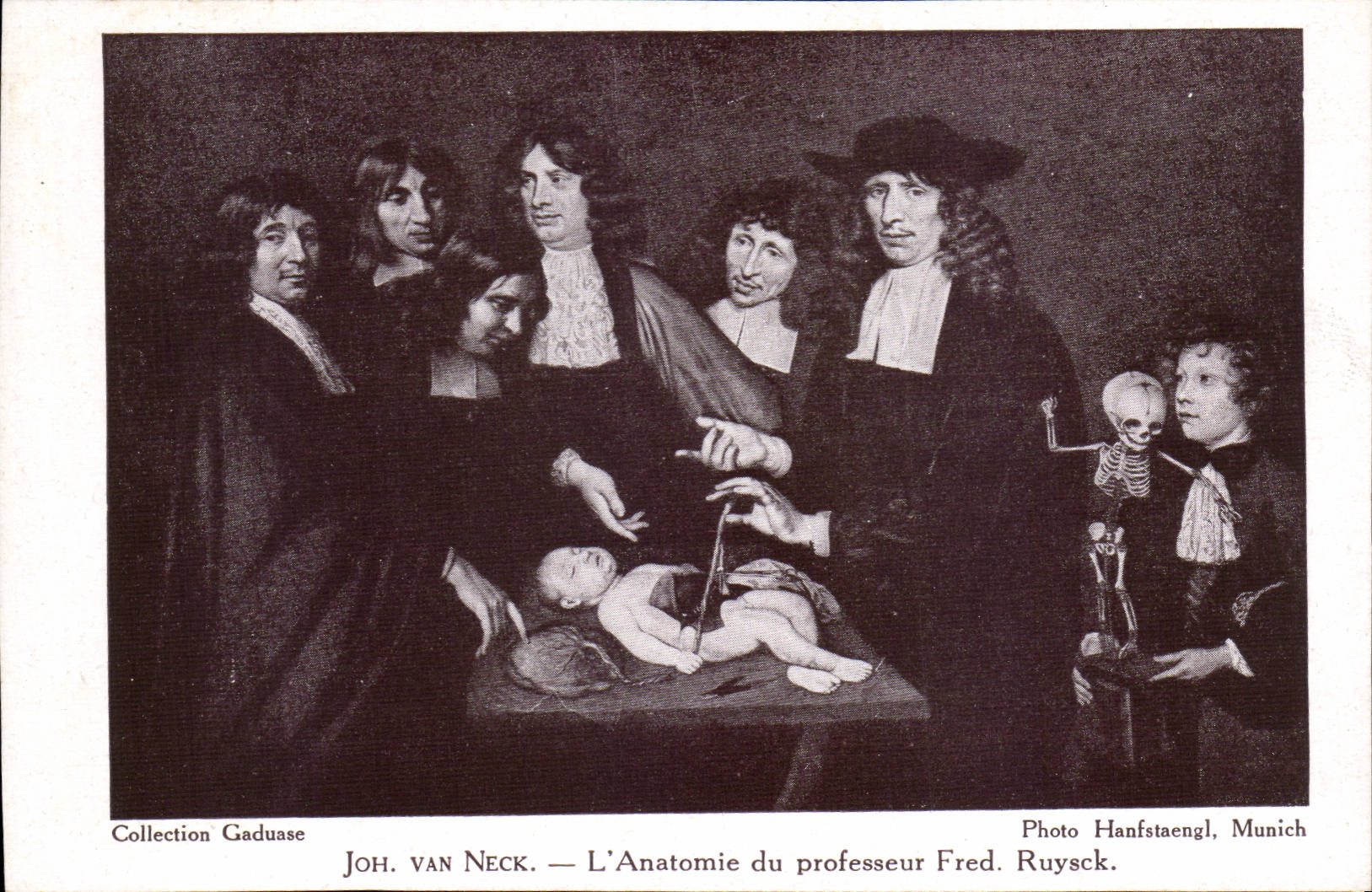 CPA Joh Van Neck L'anatomie du professeur Fred Ruysck Docteur Sante