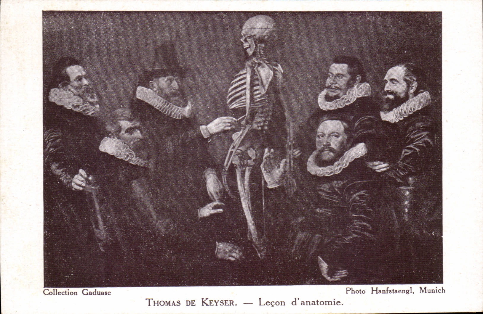 CPA Le con d'anatomie Thomas de Keyser Docteur Sante