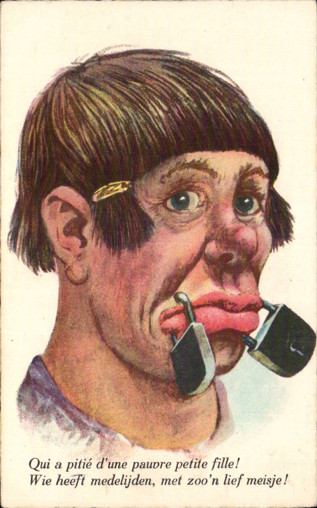 Visage caricatural avec cadenas sur la bouche — Qui a pitié d'une pauvre petite fille ! — CPAPHIL 100087