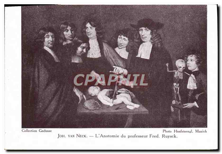 CPA Joh Van Neck L'anatomie du professeur Fred Ruysck Chrirurgie 