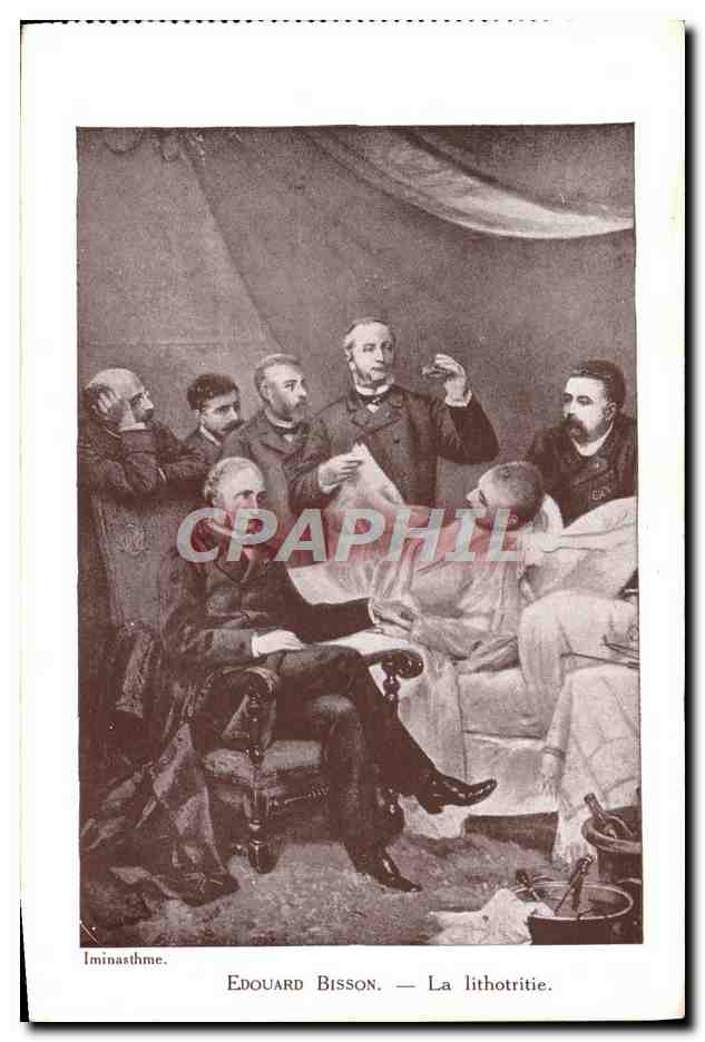 CPA Edouard Bisson La lithotritie
