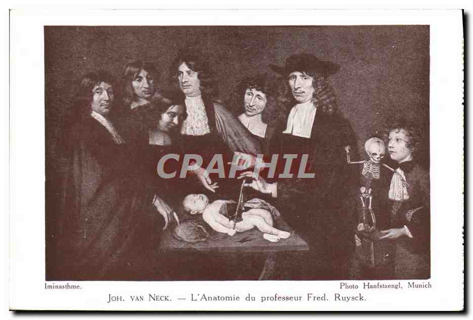 CPA Joh Van Neck L'anatomie du professeur Fred Ruysck Chrirurgie 