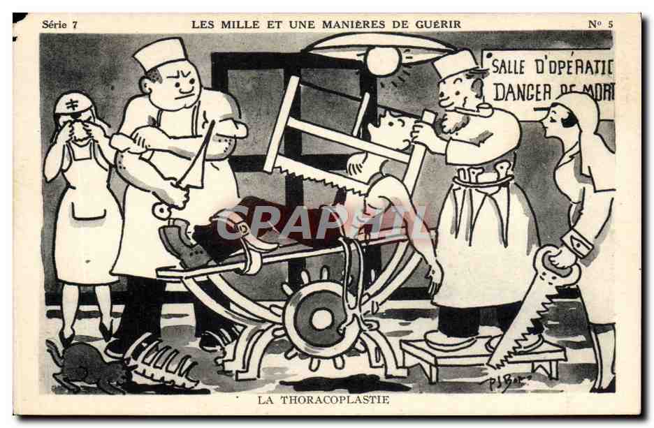Série 7 — Les mille et une manières de guérir — No 5 — La thoracoplastie — Éditeur Rhonais Malissard (Drôme)