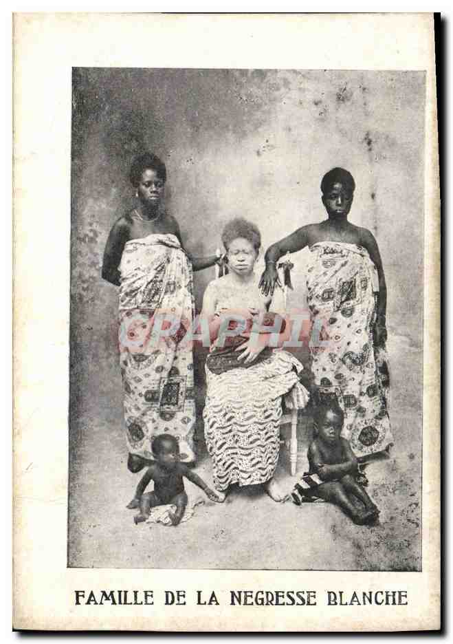 CPA Famille de la negresse blanche Albino