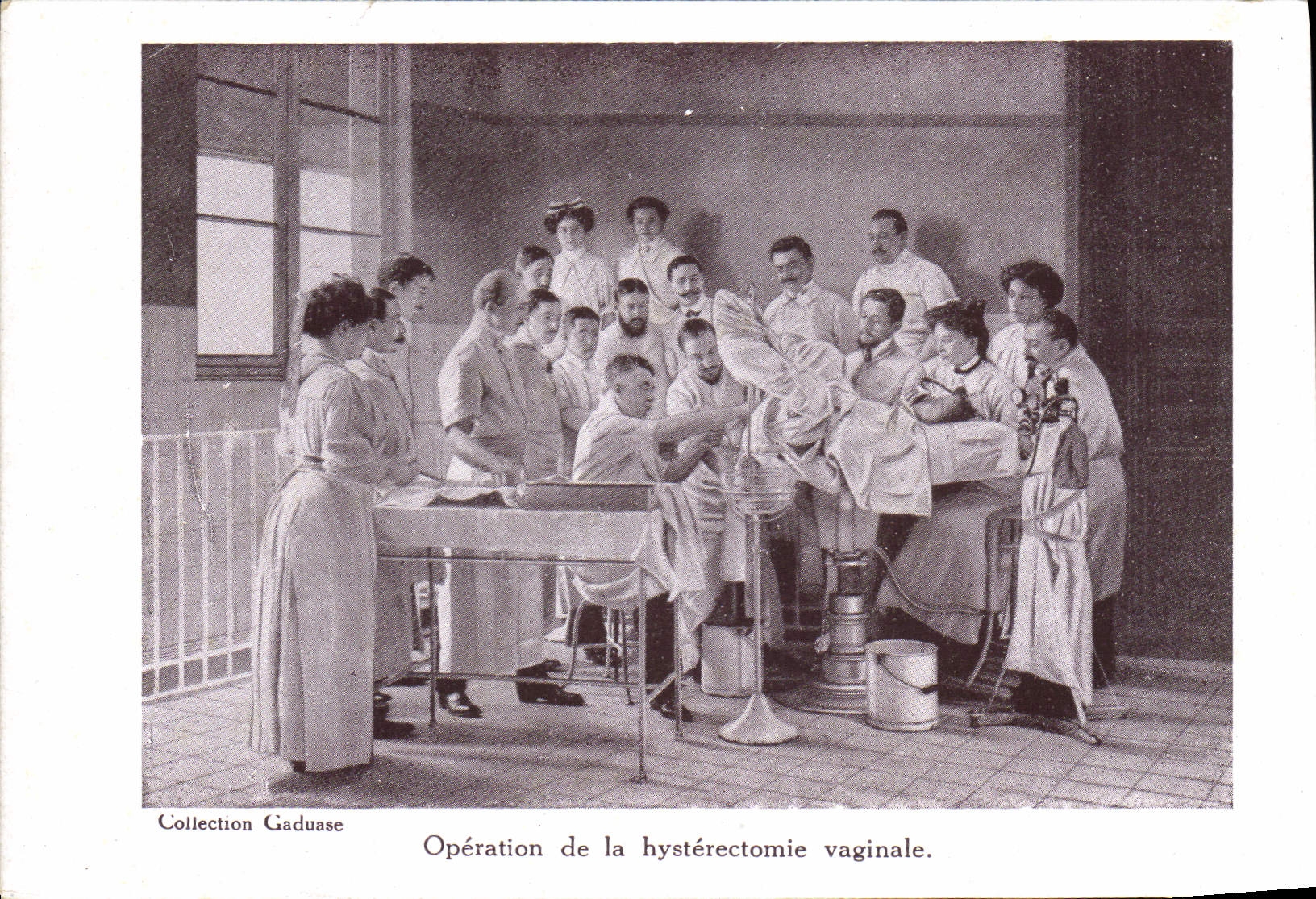 Opération de la hystérectomie vaginale — Collection Gaduase