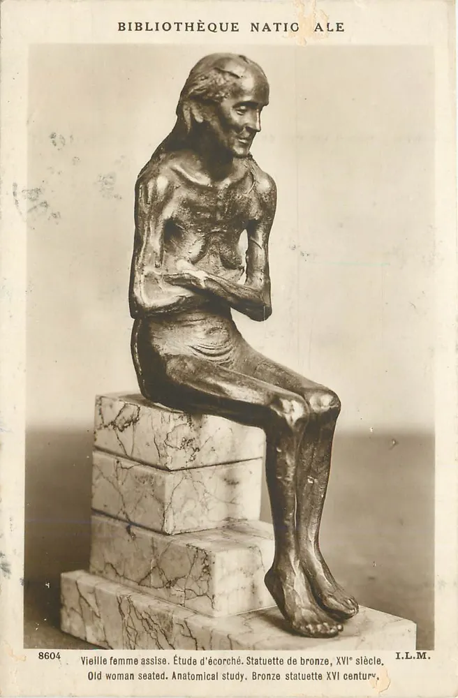 Statue einer alten sitzenden Frau — Anatomische Studie, Bronze, 16. Jahrhundert — I.L.M. n° 8604 - Vorderseite