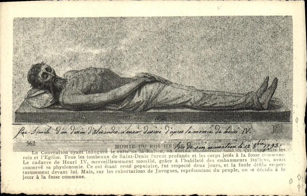 MOMIE DO REI HENRI IV — após sua momificação em 1593 — Imp. Créteil, Paris - Frente