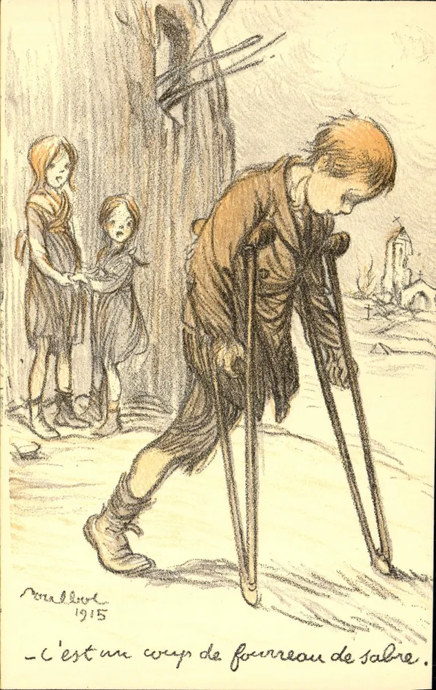 एक युद्ध के घायल — 1915 — पेरिस कलर - आगे